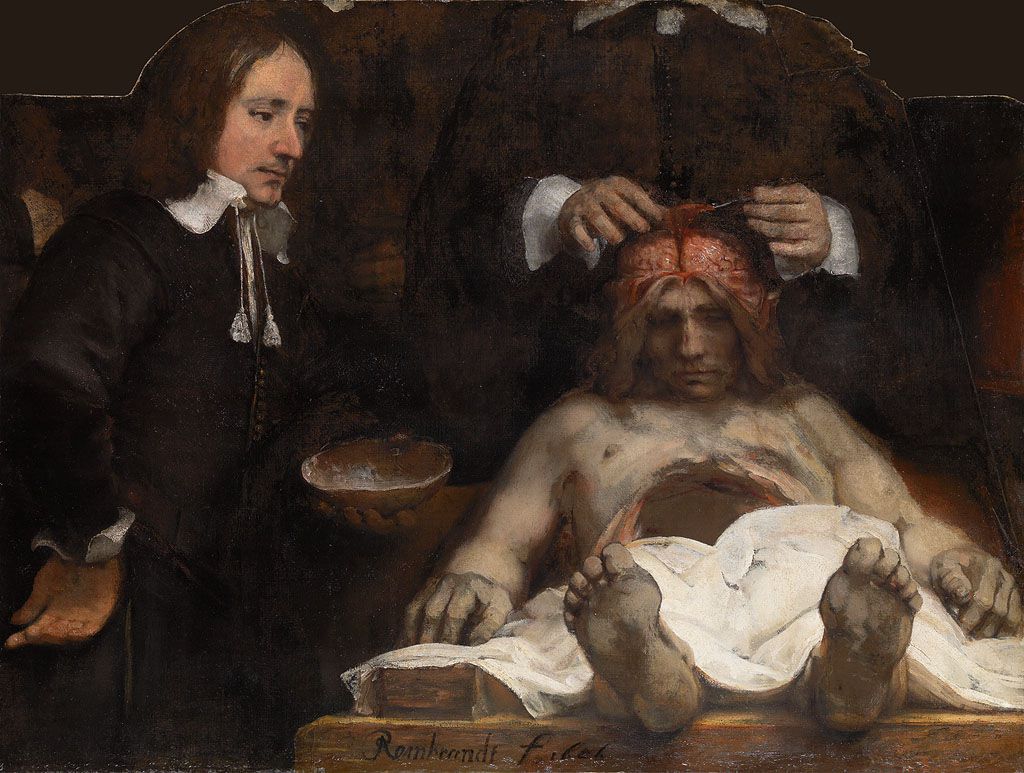 Anatomische les van Dr. Jan Deijman (fragment), door Rembrandt, 1656.